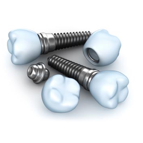 Dental Implant Restoration