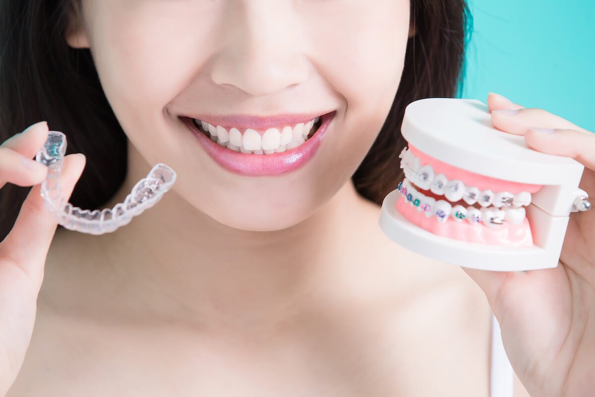 Invisalign Vs Braces: Which One is Superior?