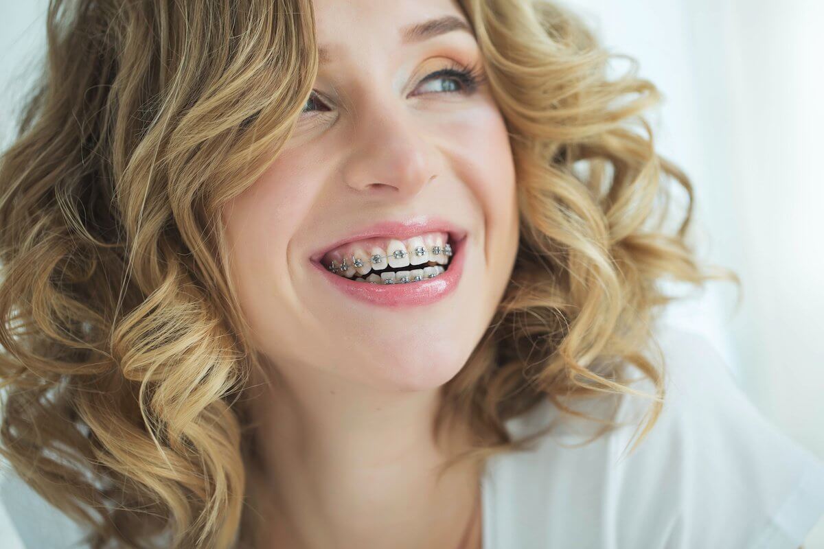 Fixing Your Smile: When To Get Braces